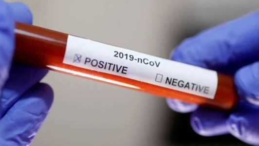 Os cientistas apontam que a Covid-19 será difícil de ser erradicada e a nova emergência é precisamente a Covid longa