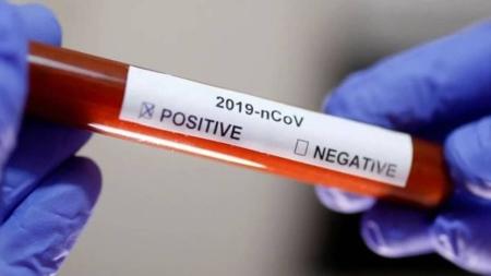 Os cientistas apontam que a Covid-19 será difícil de ser erradicada e a nova emergência é precisamente a Covid longa