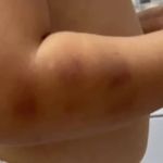 Escola entrega bebê com marca roxa no braço para a mãe em Juiz de Fora