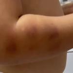 Escola entrega bebê com marca roxa no braço para a mãe em Juiz de Fora