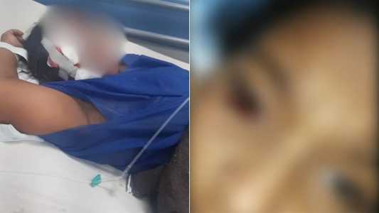 Criança de 10 anos é agredida em escola, perde a visão e mãe denuncia bullying no RJ