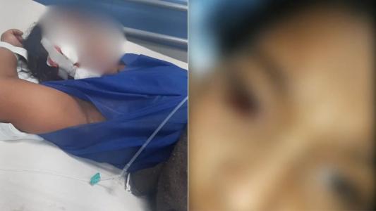 Criança de 10 anos é agredida em escola, perde a visão e mãe denuncia bullying no RJ