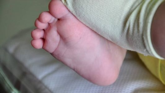 Criança ficou com bolhas no pé