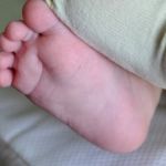 Pai deve receber indenização de R$ 25 mil por queimadura no pé do filho em Minas 