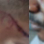 Jovem é preso após tentar matar padrasto duas vezes em menos de 12 horas na Grande BH