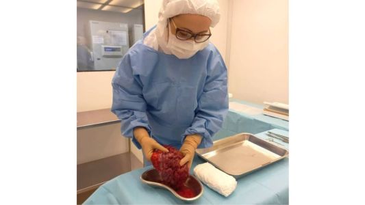 Curativo feito de placenta em estudo no Into