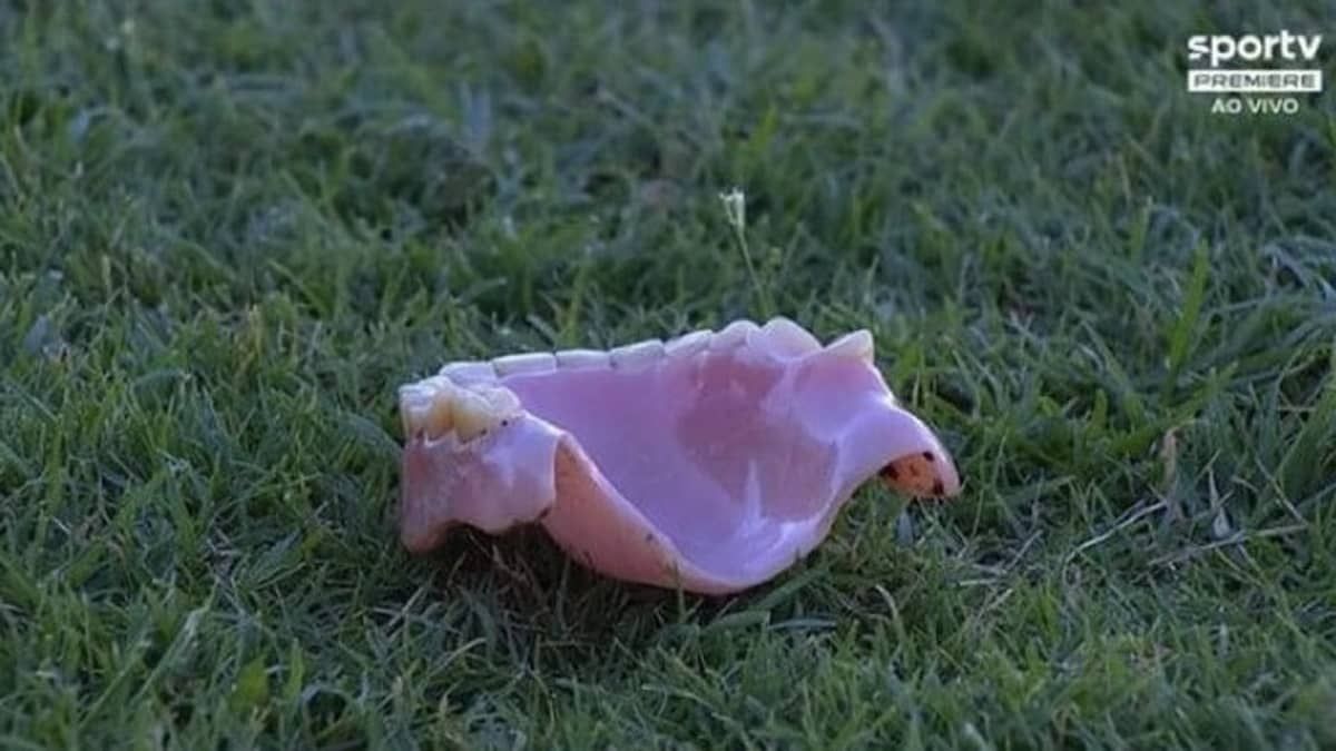 Repórter do SporTV é atingido por dentadura em jogo do Grêmio
