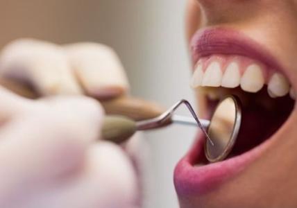 Dentes