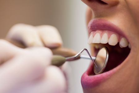 Dentista realizando limpeza de dente em paciente
