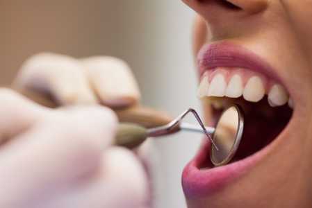 Dentista realizando limpeza de dente em paciente
