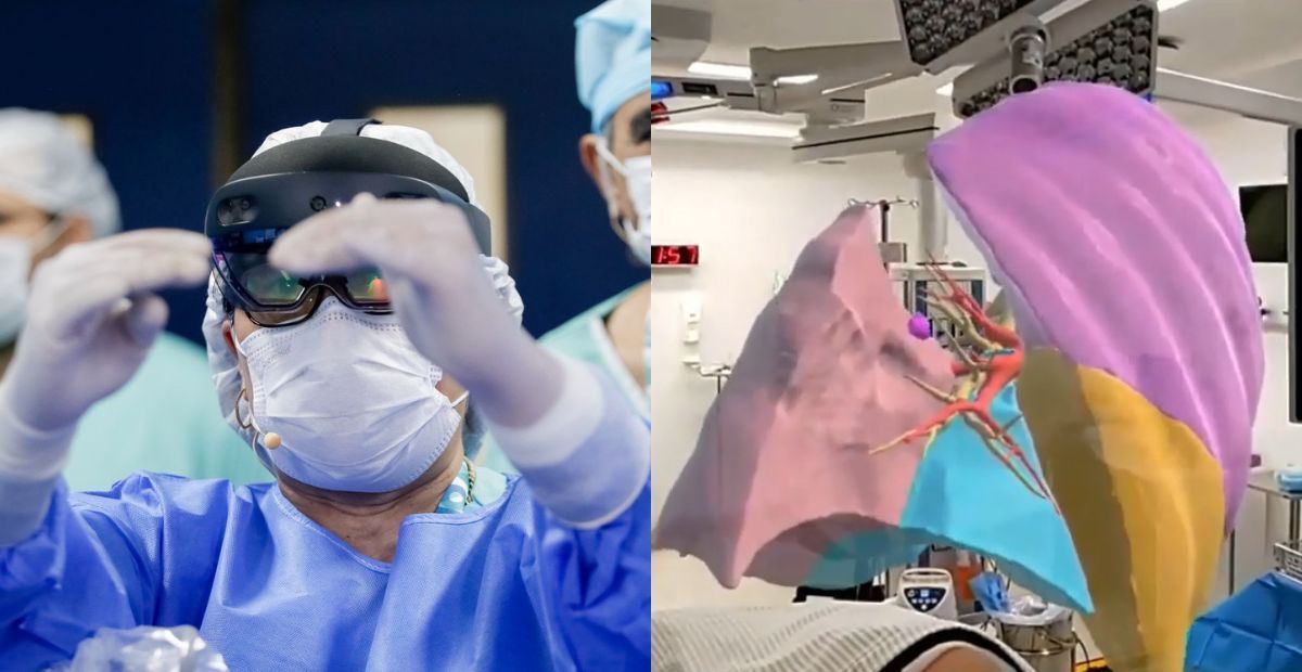 Médicos brasileiros removem câncer de pulmão usando realidade virtual e dados em 3D