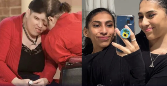 Montagem de fotos de Lori e George Schappell, os gêmeos siameses mais velhos do mundo e Carmen e Lupita, gêmeas de 23 anos