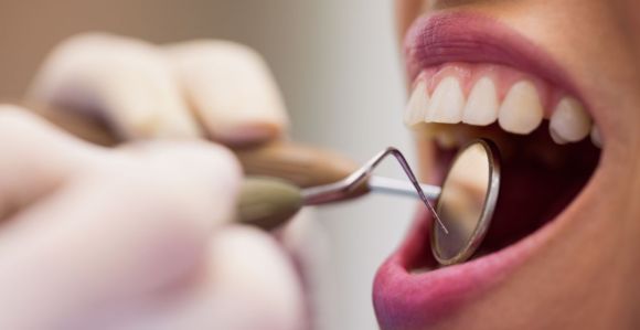 Dentista fazendo limpeza dental