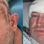 Após semanas tratando infecção no ouvido, homem descobre câncer terminal