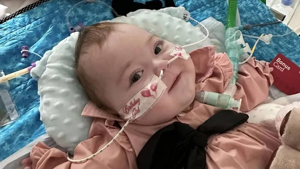 Criança 'invisível': morre bebê diagnosticado com doença que faz ossos 'desaparecerem'