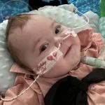 Criança 'invisível': morre bebê diagnosticado com doença que faz ossos 'desaparecerem'