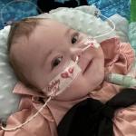 Criança 'invisível': morre bebê diagnosticado com doença que faz ossos 'desaparecerem'