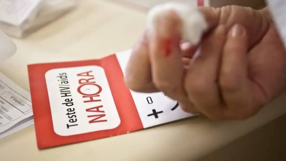 Levantamento revela que 30 brasileiros morreram de Aids por dia no ano passado