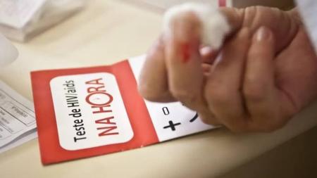 Levantamento estima que um milhão de pessoas vivam com HIV no Brasil