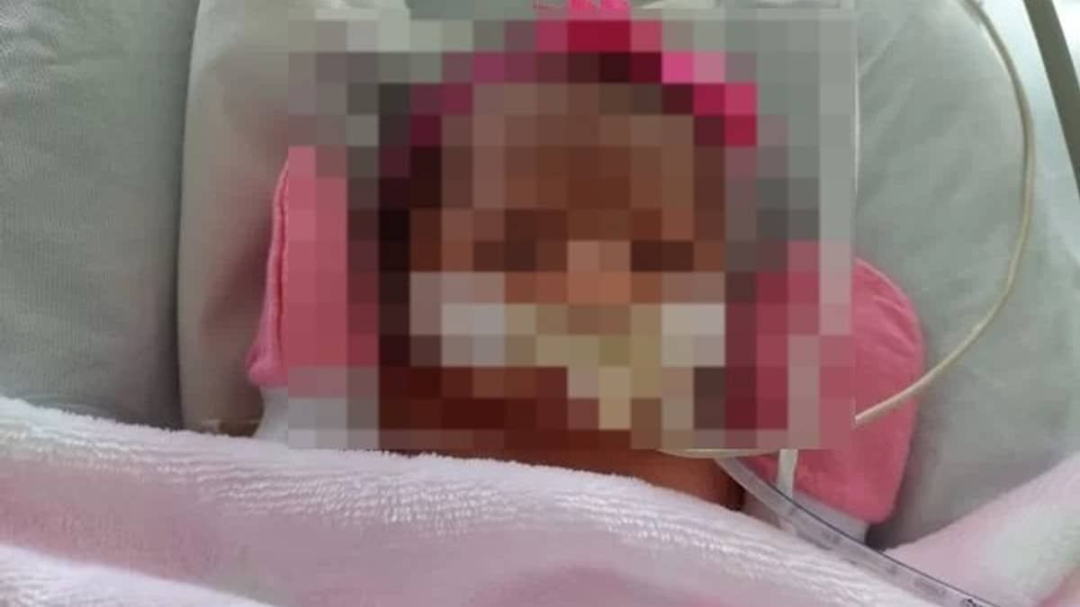 Bebê coloca marca-passo com menos de 1 hora de vida