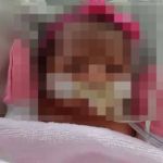 Bebê coloca marca-passo com menos de 1 hora de vida