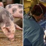 Como funciona o transplante do rim de porco para humanos? Especialista explica