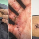 Influenciador é atacado com 38 facadas em Curitiba; suspeito seria seu 'ex'