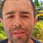 Motorista que atropelou Kayky Brito mostra resultado de harmonização facial