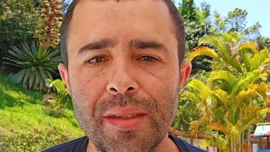 Diones Silva exibiu resultado de procedimento nas redes sociais