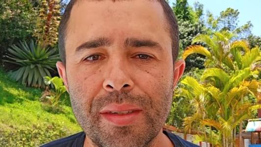 Diones Silva exibiu resultado de procedimento nas redes sociais