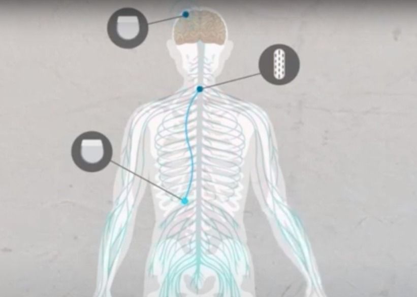 Dispositivo ajuda tetraplégicos a recuperar movimentos nas mãos e nos braços com estímulos elétricos