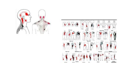 A dor miofascial causa mais frequente de dor musculoesquelética