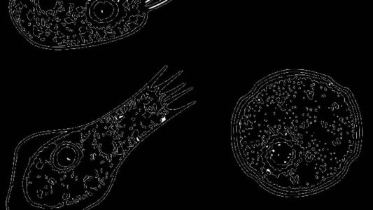 Em casos raros, a ameba pode infectar humanos entrando pelo nariz durante atividades relacionadas à água