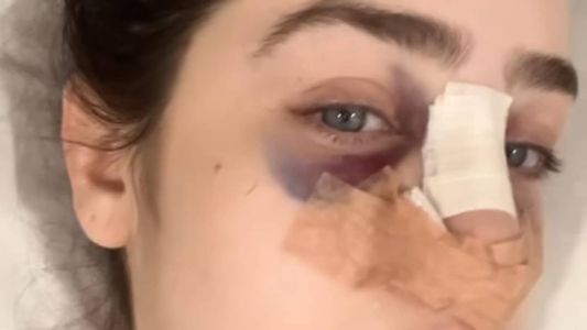 Em sua página Estela divulgou um vídeo relatando o que aconteceu e que passou por uma cirurgia, mas passa bem.