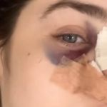 Nutricionista é agredida com socos e cabeçada por desconhecido em São Paulo