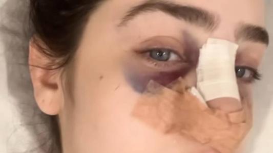 Em sua página Estela divulgou um vídeo relatando o que aconteceu e que passou por uma cirurgia, mas passa bem.