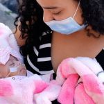 Menor bebê nascida no Brasil, de 335 gramas, tem alta após 5 meses de internação