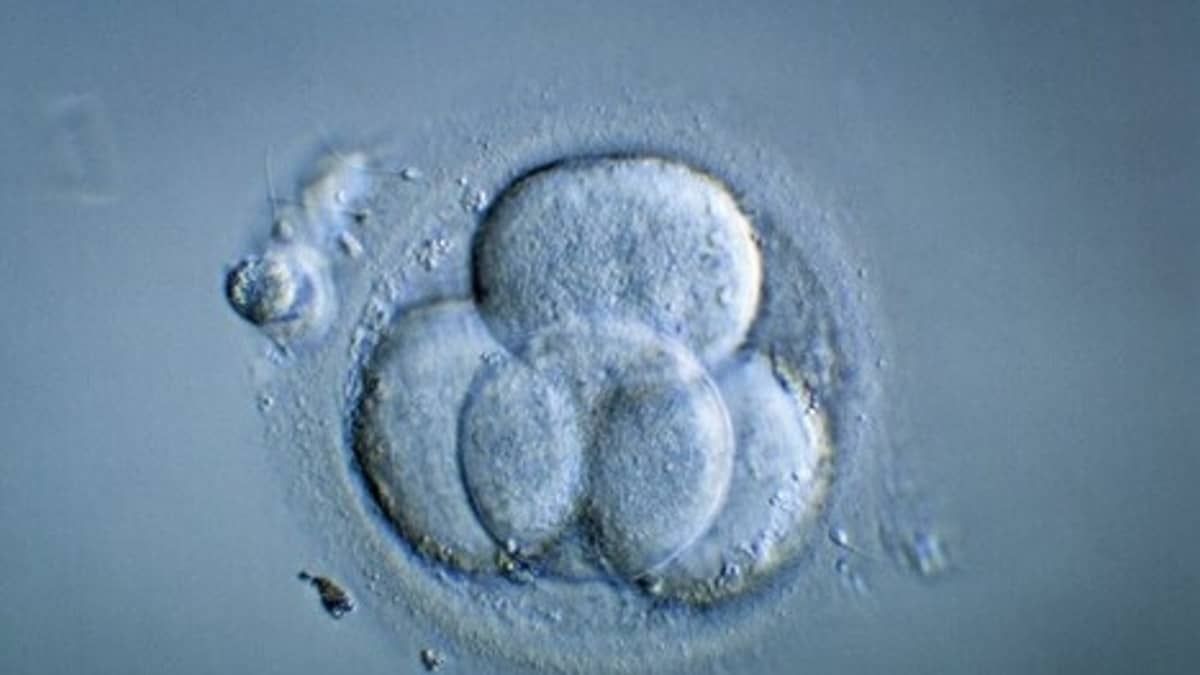 Cientistas anunciam a criação do primeiro embrião humano sintético do mundo
