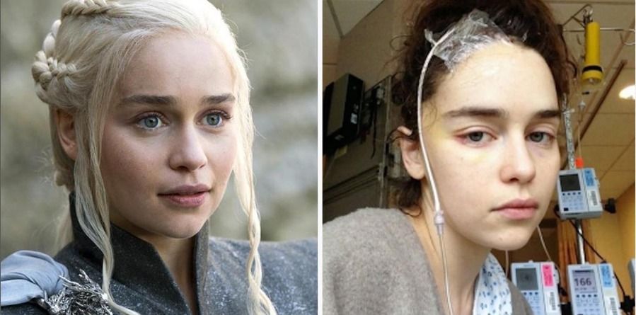 Após duas hemorragias cerebrais, Emilia Clarke de 'Game of Thrones' revela medo de ter sido demitida