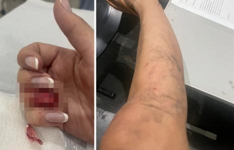 Fotos mostram agressões sofridas por vítimas em Florestal (MG)