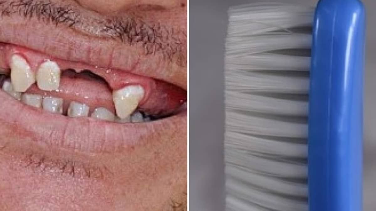 Escovas de dentes: 80% das marcas têm cerdas fora do padrão, mostra estudo 