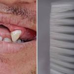 Escovas de dentes: 80% das marcas têm cerdas fora do padrão, mostra estudo 