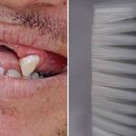 Escovas de dentes: 80% das marcas têm cerdas fora do padrão, mostra estudo