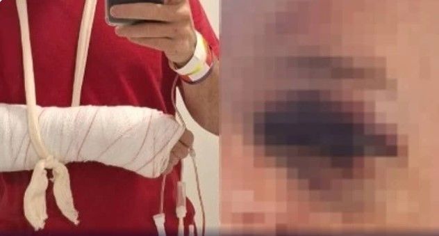Lutador de MMA que espancou médico em Centro de Saúde na Pampulha, em BH, é indiciado