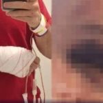 Lutador de MMA que espancou médico em Centro de Saúde na Pampulha, em BH, é indiciado