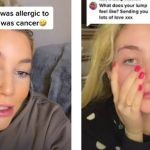 Mulher descobre câncer após suspeitar de alergia a bebidas alcoólicas