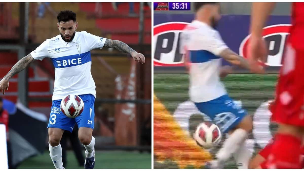 Ex-Cruzeiro sofre lesão impressionante no Chile; assista ao lance