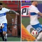 Ex-Cruzeiro sofre lesão impressionante no Chile; assista ao lance