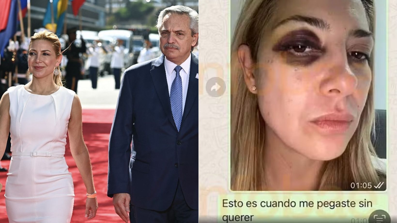 Ex-presidente da Argentina é acusado de bater na ex-primeira-dama; fotos mostram hematomas