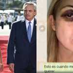 Ex-presidente da Argentina é acusado de bater na ex-primeira-dama; fotos mostram hematomas